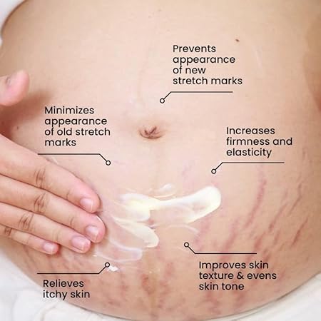Stretch Mark Repair Cream for Radiant, Smooth Skin"
