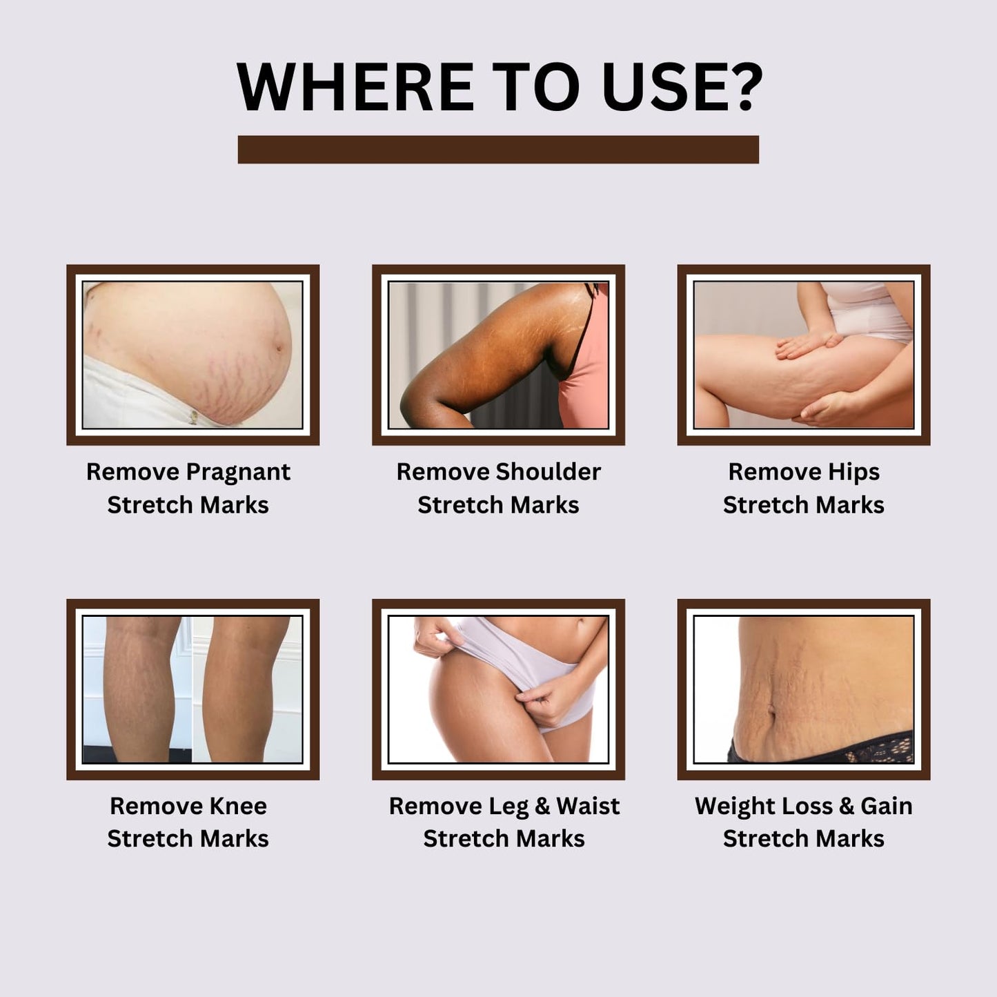 Stretch Mark Repair Cream for Radiant, Smooth Skin"