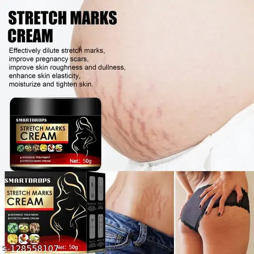 Stretch Mark Repair Cream for Radiant, Smooth Skin"