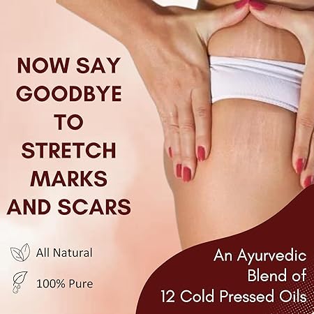 Stretch Mark Repair Cream for Radiant, Smooth Skin"